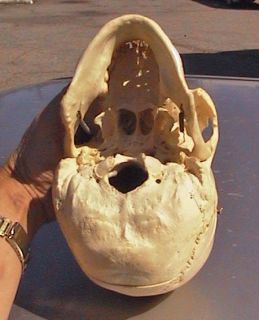 Vintage Real Human Skull Medical Dental Study Articulated Hinged Full 