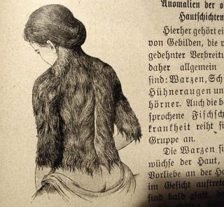 Female Author Freaks Antique Erotic German Medical Book Historic 1914