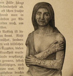 Female Author Freaks Antique Erotic German Medical Book Historic 1914