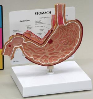 Stomach w Ulcers Medical Model GPI 2000
